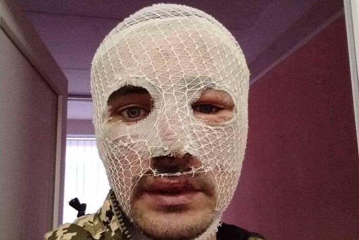 Десантник двічі вибрався з полону та привів до своїх трьох росіян